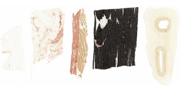 Atlas Journal - Connective Tissue, Verhoeff Stain